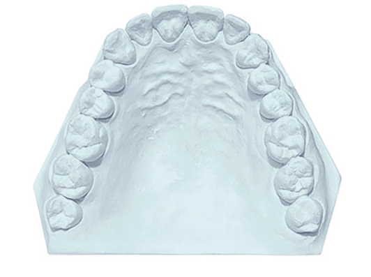 Garreco 1011550 TECSTONE BLUE 47.5 LBS
