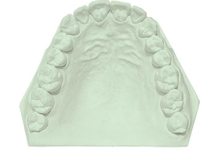 Garreco 1462525 CAD-SCAN GREEN 25 LBS