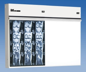 Wolf X-Ray 23402 Trimline Iii Illuminators - X-Ray Trimline Iii Illuminator, 2 In 1