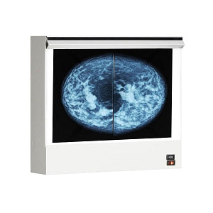 Wolf X-Ray 28001 Vuplus Mammography Viewer - Mammography X-Ray Illuminator, Single