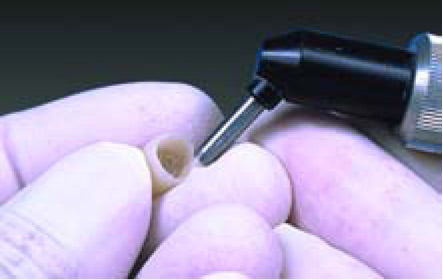 Buffalo Dental 36590 Optiblast II™